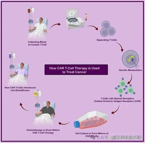 異體CAR-T細胞療法治療自身免疫病，專家解讀